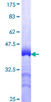 PHACTR2 Protein - 12.5% SDS-PAGE Stained with Coomassie Blue.