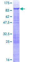PHACTR3 Protein - 12.5% SDS-PAGE of human PHACTR3 stained with Coomassie Blue