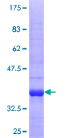 PHACTR3 Protein - 12.5% SDS-PAGE Stained with Coomassie Blue.