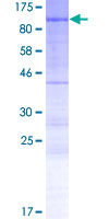 PHACTR4 Protein - 12.5% SDS-PAGE of human PHACTR4 stained with Coomassie Blue