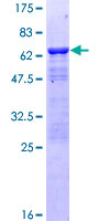 PHAP III / ANP32E Protein - 12.5% SDS-PAGE of human ANP32E stained with Coomassie Blue
