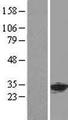 PHAP1 / ANP32A Protein - Western validation with an anti-DDK antibody * L: Control HEK293 lysate R: Over-expression lysate