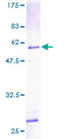 PHAP1 / ANP32A Protein - 12.5% SDS-PAGE of human ANP32A stained with Coomassie Blue