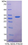 PHAP1 / ANP32A Protein - Recombinant Acidic Nuclear Phosphoprotein 32 Family, Member A By SDS-PAGE