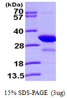 PHAP1 / ANP32A Protein