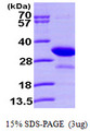 PHAP1 / ANP32A Protein
