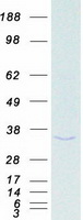 PHAP1 / ANP32A Protein - Purified recombinant protein ANP32A was analyzed by SDS-PAGE gel and Coomassie Blue Staining