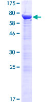 PHAX Protein - 12.5% SDS-PAGE of human RNUXA stained with Coomassie Blue