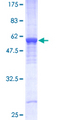 PHB / Prohibitin Protein - 12.5% SDS-PAGE of human PHB stained with Coomassie Blue