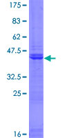 PHC3 Protein - 12.5% SDS-PAGE of human PHC3 stained with Coomassie Blue