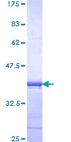 PHF1 Protein - 12.5% SDS-PAGE Stained with Coomassie Blue.