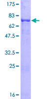 PHF10 Protein - 12.5% SDS-PAGE of human PHF10 stained with Coomassie Blue