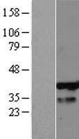 PHF13 Protein - Western validation with an anti-DDK antibody * L: Control HEK293 lysate R: Over-expression lysate