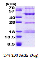 PHF13 Protein