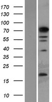PHF14 Protein - Western validation with an anti-DDK antibody * L: Control HEK293 lysate R: Over-expression lysate