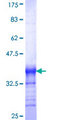 PHF2 Protein - 12.5% SDS-PAGE Stained with Coomassie Blue.