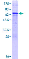 PHF20L1 Protein - 12.5% SDS-PAGE of human PHF20L1 stained with Coomassie Blue