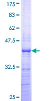 PHF21A / BHC80 Protein - 12.5% SDS-PAGE Stained with Coomassie Blue.