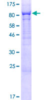 PHF21B Protein - 12.5% SDS-PAGE of human PHF21B stained with Coomassie Blue