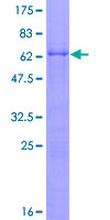 PHF6 Protein - 12.5% SDS-PAGE of human PHF6 stained with Coomassie Blue