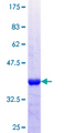 PHF6 Protein - 12.5% SDS-PAGE Stained with Coomassie Blue.