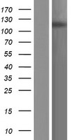 PHF8 Protein - Western validation with an anti-DDK antibody * L: Control HEK293 lysate R: Over-expression lysate