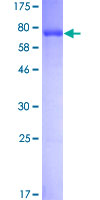 PHGDH Protein - 12.5% SDS-PAGE of human PHGDH stained with Coomassie Blue
