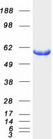 PHGDH Protein - Purified recombinant protein PHGDH was analyzed by SDS-PAGE gel and Coomassie Blue Staining
