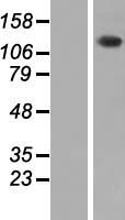 PHKA2 Protein - Western validation with an anti-DDK antibody * L: Control HEK293 lysate R: Over-expression lysate