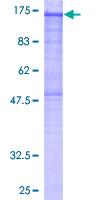PHKA2 Protein - 12.5% SDS-PAGE of human PHKA2 stained with Coomassie Blue