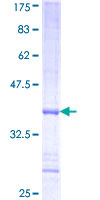 PHKA2 Protein - 12.5% SDS-PAGE Stained with Coomassie Blue.