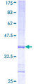 PHKA2 Protein - 12.5% SDS-PAGE Stained with Coomassie Blue.