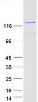PHKA2 Protein - Purified recombinant protein PHKA2 was analyzed by SDS-PAGE gel and Coomassie Blue Staining