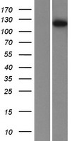 PHKB Protein - Western validation with an anti-DDK antibody * L: Control HEK293 lysate R: Over-expression lysate