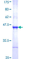 PHKB Protein - 12.5% SDS-PAGE Stained with Coomassie Blue.