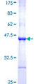 PHKB Protein - 12.5% SDS-PAGE Stained with Coomassie Blue.