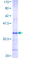 PHKG1 Protein - 12.5% SDS-PAGE Stained with Coomassie Blue.