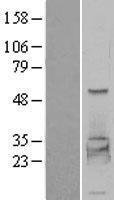 PHKG2 Protein - Western validation with an anti-DDK antibody * L: Control HEK293 lysate R: Over-expression lysate