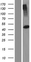 PHKG2 Protein - Western validation with an anti-DDK antibody * L: Control HEK293 lysate R: Over-expression lysate