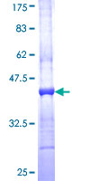 PHKG2 Protein - 12.5% SDS-PAGE Stained with Coomassie Blue.