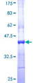 PHKG2 Protein - 12.5% SDS-PAGE Stained with Coomassie Blue.