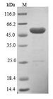 PHLDA1 Protein - (Tris-Glycine gel) Discontinuous SDS-PAGE (reduced) with 5% enrichment gel and 15% separation gel.