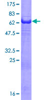 PHLDA1 Protein - 12.5% SDS-PAGE of human PHLDA1 stained with Coomassie Blue