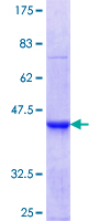 PHLDA1 Protein - 12.5% SDS-PAGE Stained with Coomassie Blue