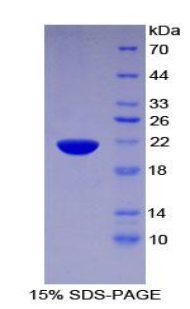 PHLDA2 / TSSC3 Protein - Recombinant Pleckstrin Homology Like Domain Family A, Member 2 By SDS-PAGE
