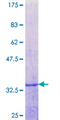 PHLDA3 Protein - 12.5% SDS-PAGE Stained with Coomassie Blue.