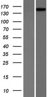 PHLPP2 / PHLPPL Protein - Western validation with an anti-DDK antibody * L: Control HEK293 lysate R: Over-expression lysate