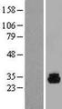 PHOSPHO1 Protein - Western validation with an anti-DDK antibody * L: Control HEK293 lysate R: Over-expression lysate