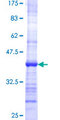 PHOSPHO1 Protein - 12.5% SDS-PAGE Stained with Coomassie Blue.