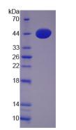 Phospholipase D Protein - Recombinant Phospholipase D By SDS-PAGE